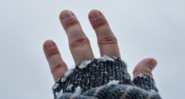 preventing cold related injuries